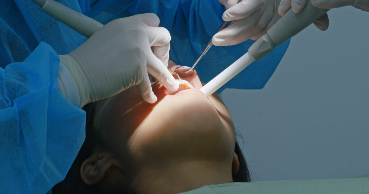 edad minima para un implante dental