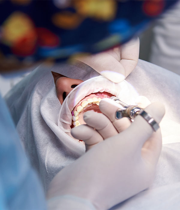 anestesia dental