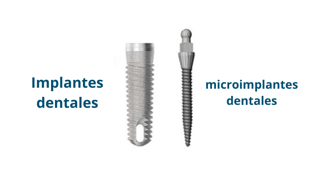 mini implantes dentales, microimplantes 