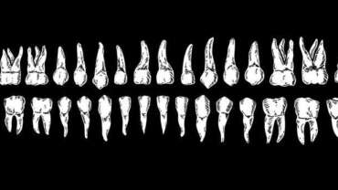 endodoncia multiradicular