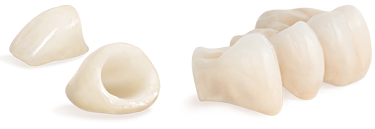 coronas estéticas coronas dentales
