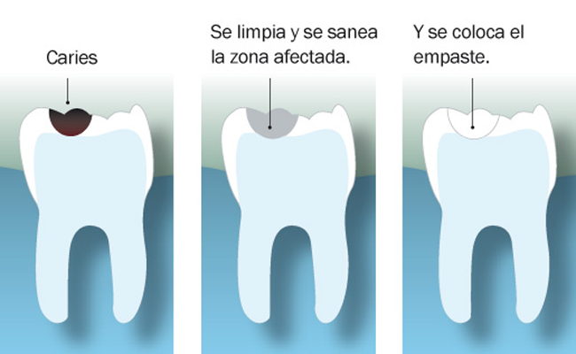 fases del empaste dental
