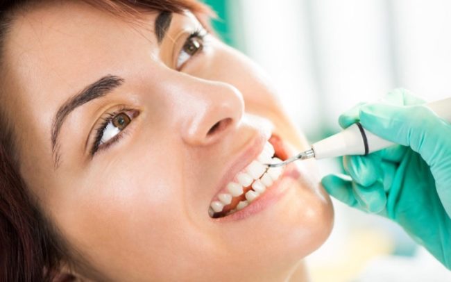 limpieza dental por ultrasonidos