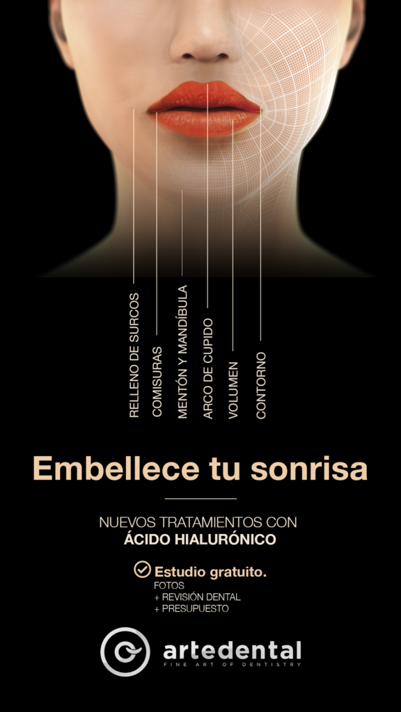 Estética perioral, estética peribucal, embellecimiento de sonrisas, rejuvenecimiento oral